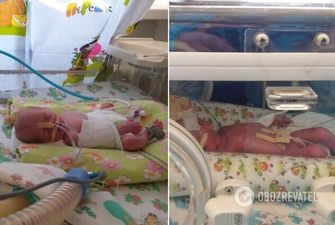 В Днепре спасают крохотных новорожденных двойняшек: фото