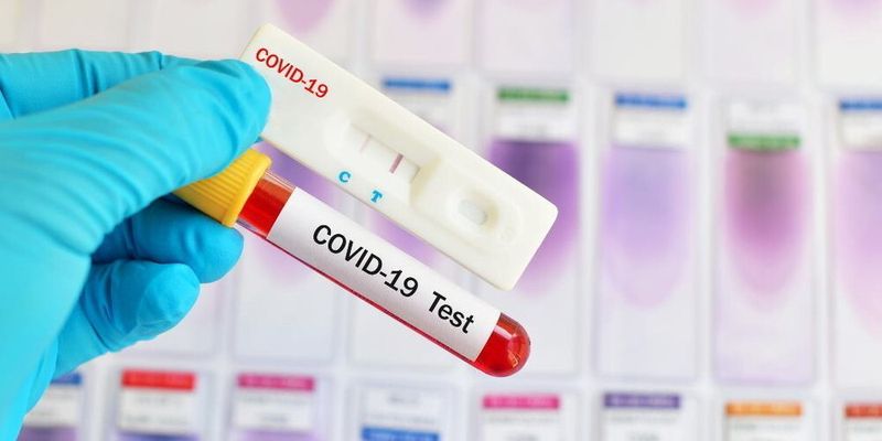 Доведений довгий імунітет після одужання від COVID-19