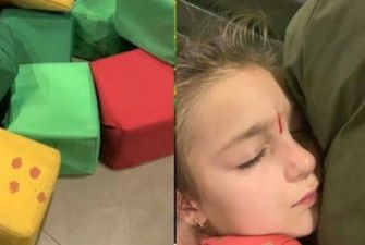 В игровом центре в Днепре пострадала девочка: рассекла лоб о пружину