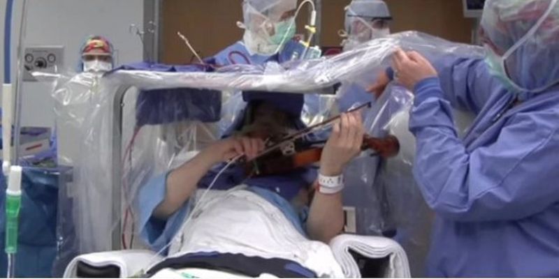 Скрипалька грала на інструменті, коли їй видаляли пухлину у мозку: унікальні фото, відео