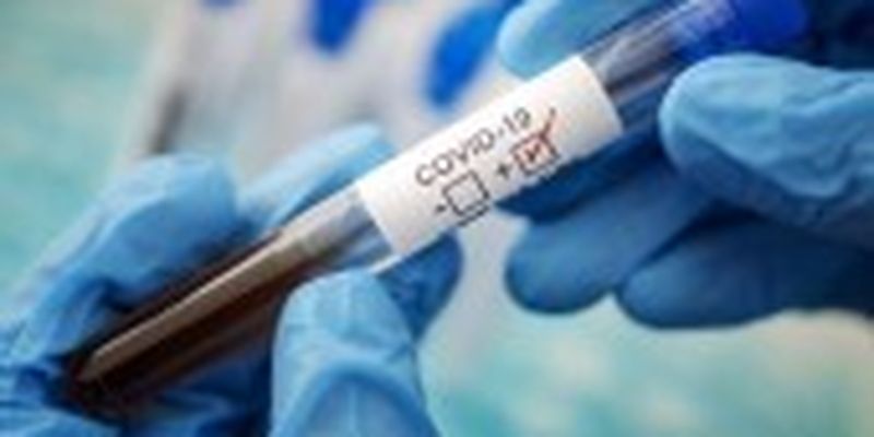 В Херсонській області зафіксовано 215 нових випадків COVID-19