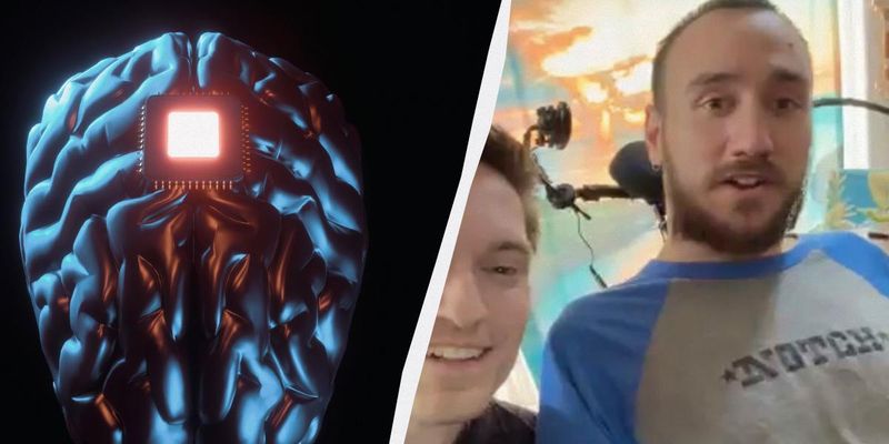 В компании Илона Маска показали первого человека, которому вживили чип в мозг