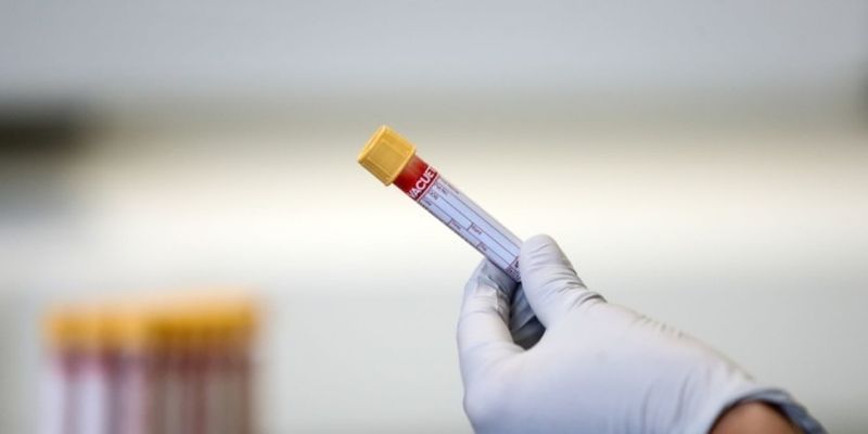 В Испании обнаружили «бразильский» штамм коронавируса