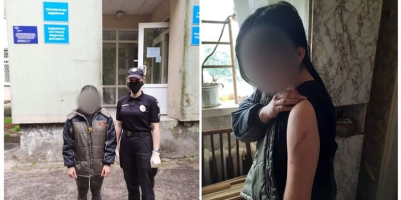 В Луганской области мать "воспитывала" дочь, посадив на цепь