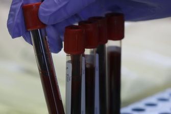 Перехресний імунітет: українські науковці зробили важливе відкриття для розробників вакцин від коронавірусу