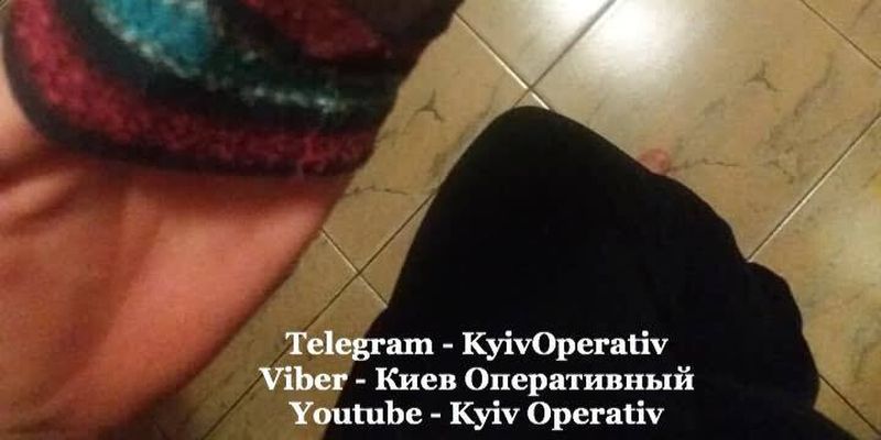 В Киеве агрессивная собака напала на маленького ребенка: подробности ЧП и фото