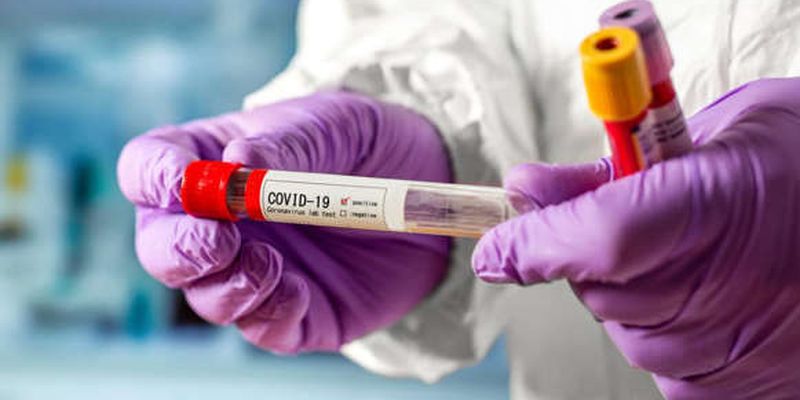 У світі коронавірусом заразилися вже майже 45 млн людей