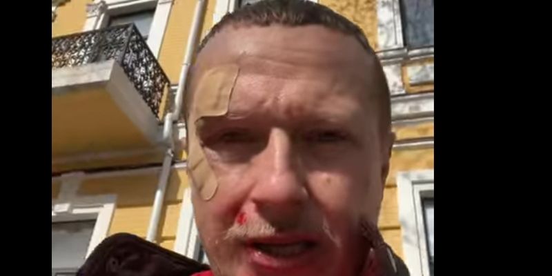 Журналиста и ведущего шоу "Телевидение Торонто" Майкла Щура избили в центре Киева