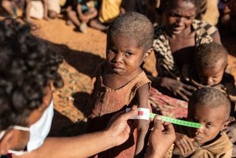 Голодная смерть грозит восьми миллионам детей в 15 странах мира – ЮНИСЕФ